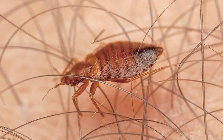 bed-bug-biting-skin-2-Copy